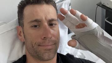 Vincenzo Nibali posa tras su operación de la fractura de muñeca tras sufrir una caída mientras entrenaba.