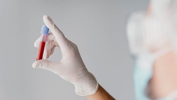 Detectan un misterioso anticuerpo en una mujer y termina siendo un nuevo tipo de sangre no conocido hasta la fecha