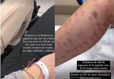 Adara Molinero, tras sufrir una negligencia médica: “Jamás recibí unas disculpas”