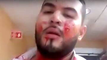'La Voz': concursante sube un vídeo tras recibir varios disparos