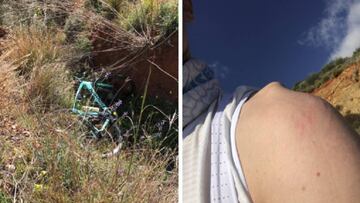 Así quedó la bicicleta y la clavícula del corredor del Lotto Jumbo-Visma.