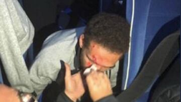 Jugador del Al-Ahly, herido por el ataque al autobús de su equipo.