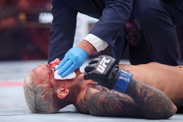 Charles Oliveira recibe atención médica tras ser noqueado por Ilia Topuria.