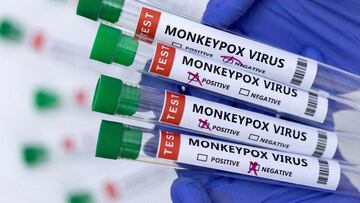 Los casos de viruela de mono aumentan en Estados Unidos, sin embargo, las autoridades sanitarias descartan emergencia de salud pública. Aquí los detalles.