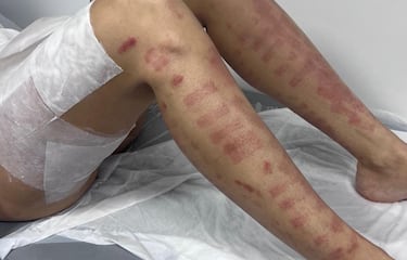 Adara Molinero, tras sufrir una negligencia médica: “Jamás recibí unas disculpas”