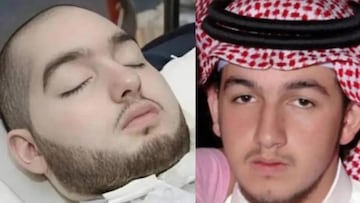 Muere el “príncipe durmiente”: llevaba 20 años en coma