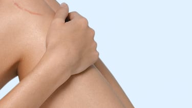 Repara tus cicatrices: así lo consigue la crema con rosa mosqueta más vendida