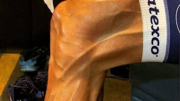 Pieter Serry mostró a sus seguidores cómo quedó la pierna de Tom Boonen después de un entrenamiento en Argentina.