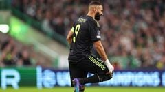 Karim Benzema has reportedly not suffered any serious damage to his knee as a result of the injury he picked up in Real Madrid’s victory at Celtic.