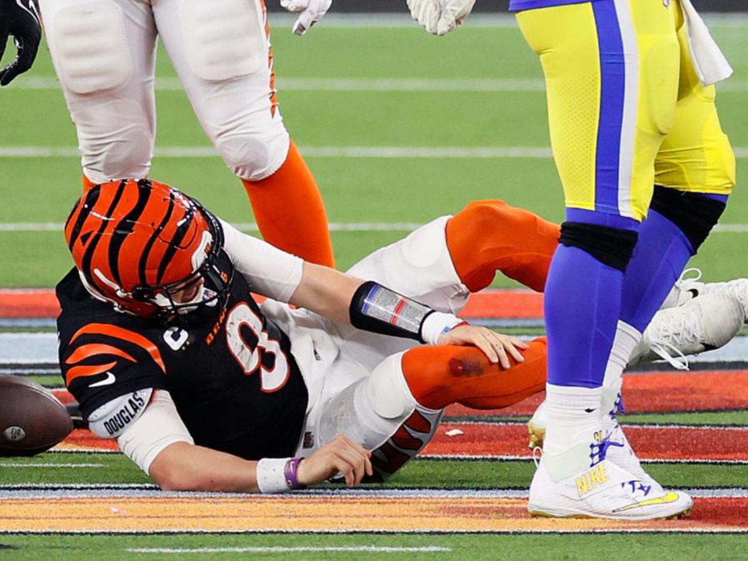Bengals' Joe Burrow suffered sprained MCL in Super Bowl loss to