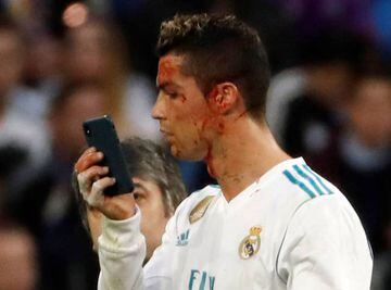 Ronaldo checks his face