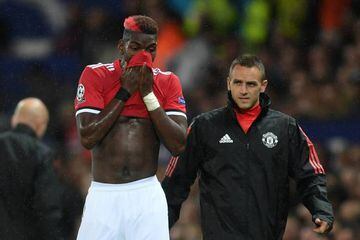 Pogba forced off with injury against Basel