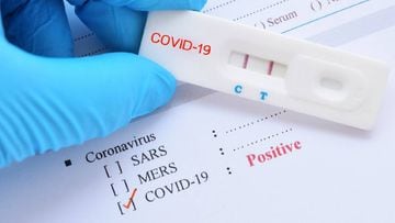 Examen PCR por COVID-19 a domicilio: cómo solicitar la prueba