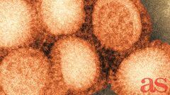 Why 'Spanish Flu' got its name
