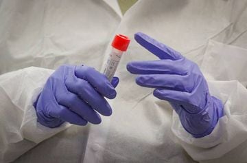 A scientist holds a sample during Covid-19 testing at New York City's health department, during the outbreak of the coronavirus disease.