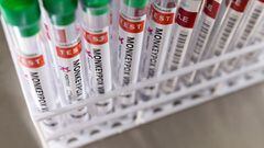 Test tubes labelled Monkeypox virus; are seen in this illustration taken May 22, 2022. REUTERS/Dado Ruvic/Illustration