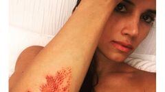 India Mart&iacute;nez acaba herida tras ser atracada en la calle