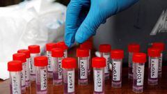 Cient&iacute;ficos del Departamento de Defensa de Estados Unidos desarrollaron un test que puede detectar pacientes con coronavirus, luego de 24 horas de ser infectados.