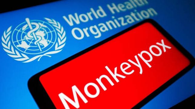 Monkeypox is a new global threat. African scientists know what the world is  up against, Science