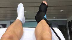 Bale viajó a Londres y será operado hoy de su tobillo