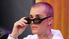 Justin Bieber explicó a sus fans por qué tuvo que posponer algunos conciertos, revelando que tiene síndrome de Ramsay Hunt y parálisis facial.