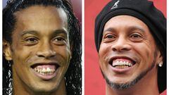 Deportistas y famosos a los que el dentista les cambió la vida
