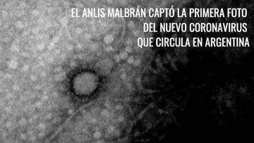 Coronavirus: toman la primera imagen del virus que circula en Argentina