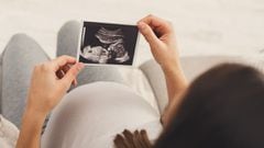 Aborto Legal: ¿cuándo podría ser aprobada la ley en el Senado?