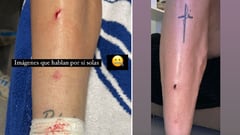 Imágenes de cómo quedó la pierna derecha de Rafa Marín tras el encuentro ante el Barcelona.