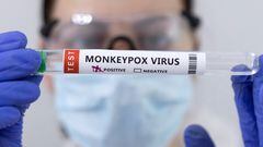 Estados Unidos declara emergencia de salud pública por aumento de casos de viruela de mono, así lo informó el secretario de Salud, Xavier Becerra.