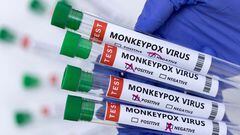 El brote de la viruela del mono continúa empeorando en USA. Te compartimos cuántos nuevos posibles casos hay en Estados Unidos y las últimas noticias.