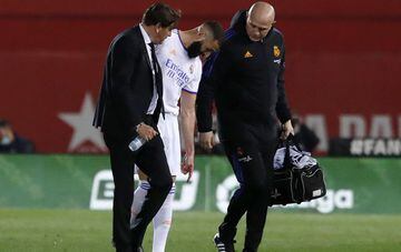 Benzema limped off against Mallorca with a calf injury.