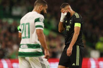 Benzema se marchó lesionado de Celtic Park.