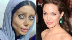 Imágenes de la joven Sahar Tabar después de sus numerosas operaciones para parecerse a Angelina Jolie y de la actriz.