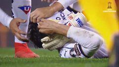 La terrible acción de la triple fractura al evitar gol de Tévez