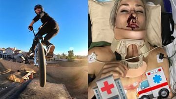Caroline Buchanan rueda con su bici de BMX y mostr&oacute; su heridas desde el hospital tras ser atropellada por un coche.