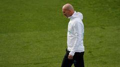 Zidane tiene exceso de sudoraci&oacute;n, entre otros factores de su calvicie.