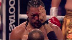 El árbitro revisándole el ojo derecho a Joe Joyce en su último combate.