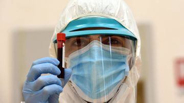 Un profesional de la salud muestra un tubo de ensayo con sangre para una prueba serol&oacute;gica que puede identificar qui&eacute;n contrajo el coronavirus. Mila, Italia, 2020. 