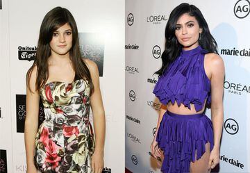 Al igual que su hermana, Kylie Jenner decidió resaltar su belleza con un par de cirugías estéticas.