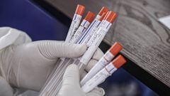 Viales con muestras para pruebas del coronavirus