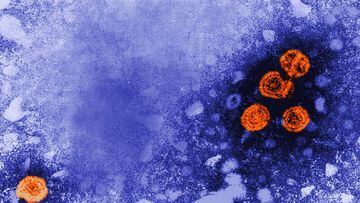 Hepatitis infantil aguda: CDMX detecta cuatro casos sospechosos