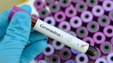 Coronavirus v&iacute;a Getty Images, 2020.