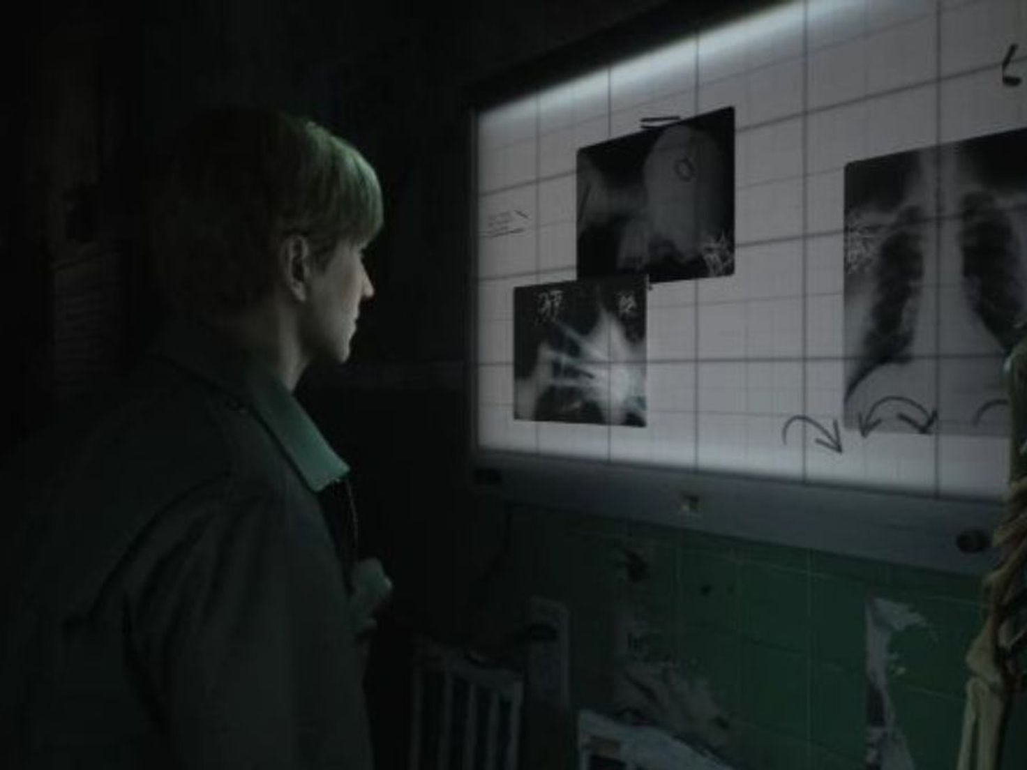 The Medium: New Xbox Series X Horror Game Channels Silent Hill