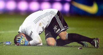 Lyon's Portuguese goalkeeper Anthony Lopes reacts after a firecracker exploded beside him during the French L1 football match between Metz (FCM) and Lyon (OL) on December 3, 2016 at Saint Symphorien stadium in Longeville-Les-Metz,