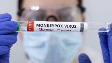 Estados Unidos declara emergencia de salud pública por aumento de casos de viruela de mono, así lo informó el secretario de Salud, Xavier Becerra.