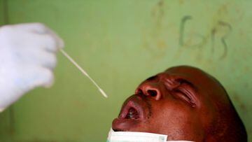 FILE PHOTO: A man reacts as a medical worker takes a mouth sample for coronavirus during a community testing, as authorities race to contain the spread of coronavirus disease (COVID-19) in Abuja, Nigeria April 15, 2020. REUTERS/Afolabi Sotunde/File Photo