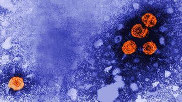 Archivo - Imagen de microscop&iacute;a electr&oacute;nica de transmisi&oacute;n coloreada digitalmente revela la presencia de viriones de la hepatitis B (de color naranja).