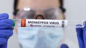 Test tubes labelled &quot;Monkeypox virus positive&quot; are seen in this illustration taken May 23, 2022. REUTERS/Dado Ruvic/Illustration