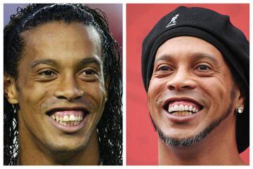 El brasileño es uno de los futbolistas que más ha sonreído dentro del terreno de juego, por lo que llamó mucho la atención cuando después de su retirada decidió pasar por el dentista para lucir una nueva y mejorada sonrisa.